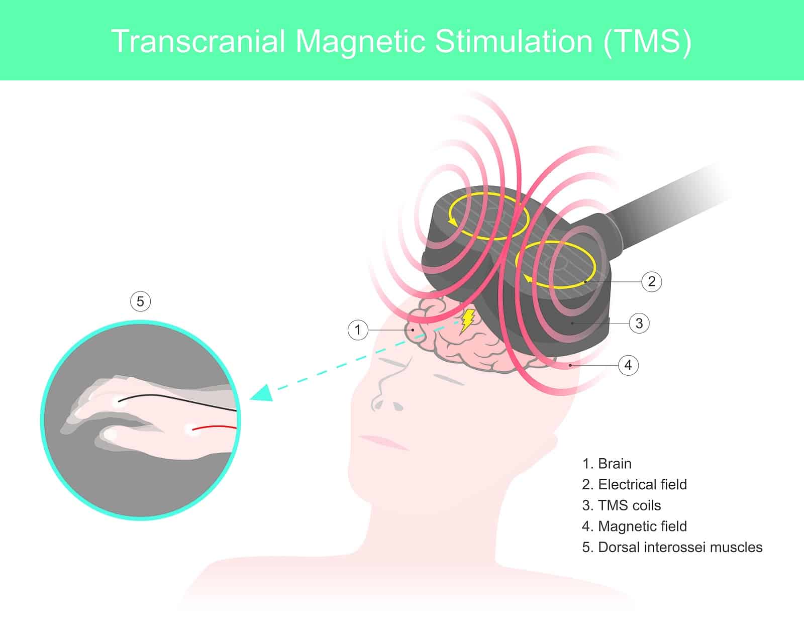 How Does TMS Therapy Work?